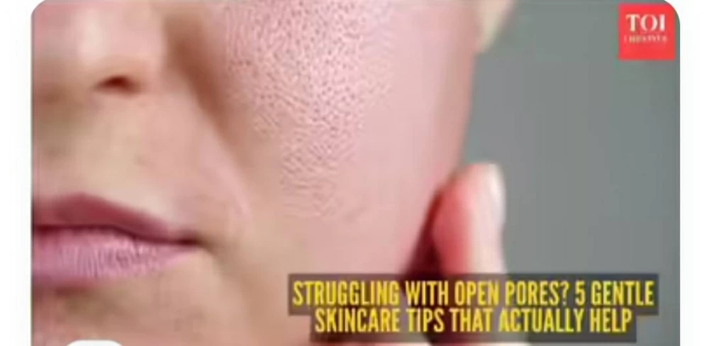 تعانين بشدة منها؟.. طرق التخلص من المسام الواسعة فى الوجه