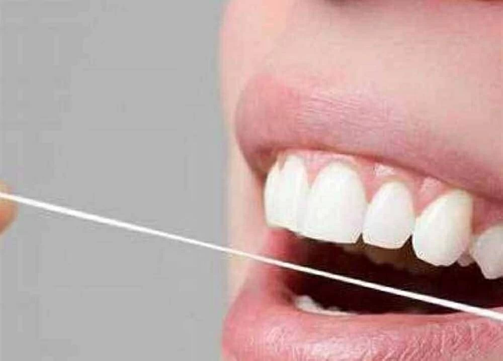 بأقل تكلفة وبدون كيماويات ضارة.. أفضل طريقة لتبييض الأسنان في البيت