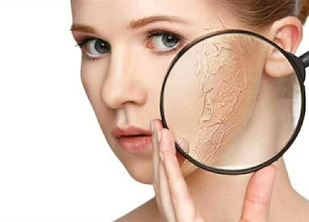 «لو جلدك بينشف ويتشقق بسرعة».. 3 علاجات منزلية للعناية بالبشرة في الشتاء